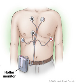 Holter